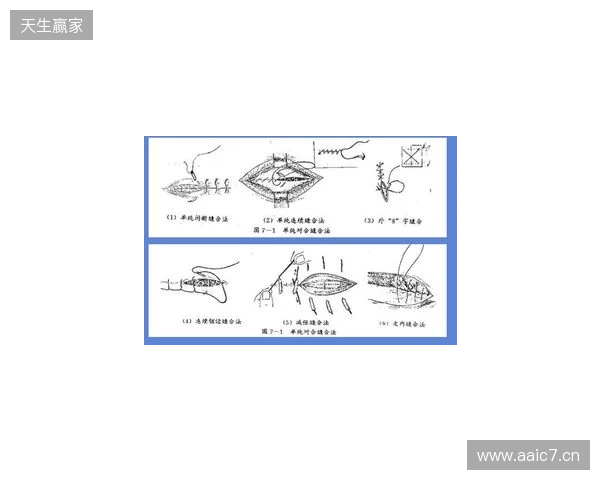 广州豹官方:杨浩眉弓伤口缝合30余针,预计5-7天后拆线